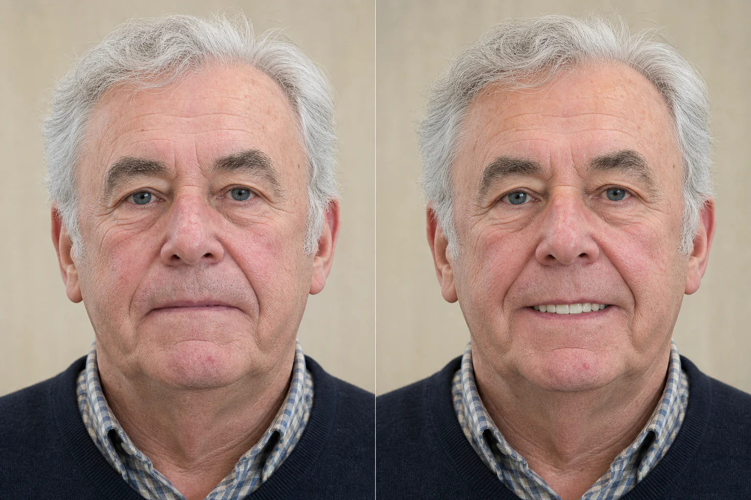 Denture-to-fixed concept: illustrative before and after visual