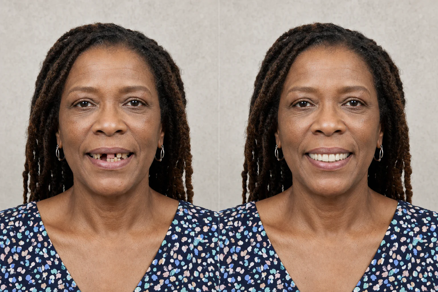 Dual-arch concept: AI-created illustrative before-and-after dental visual