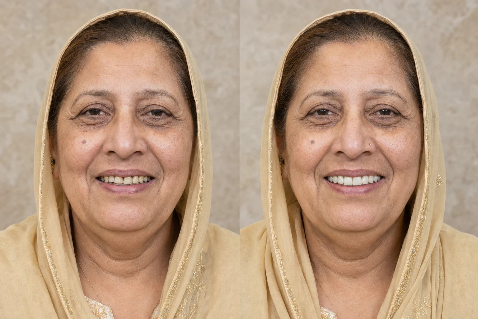 Failing bridge concept: AI-created illustrative before-and-after dental visual