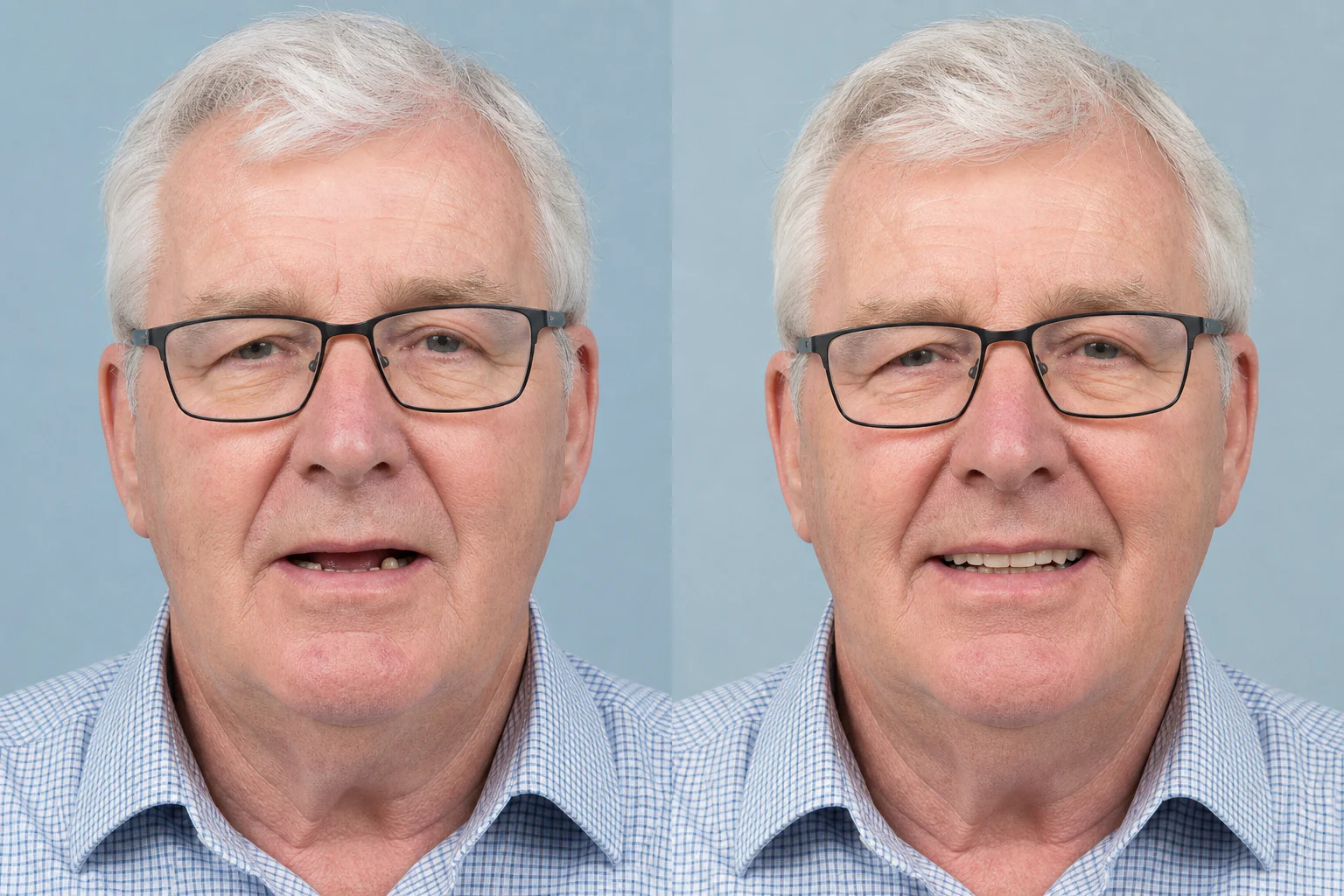 Lower support concept: AI-created illustrative before-and-after dental visual